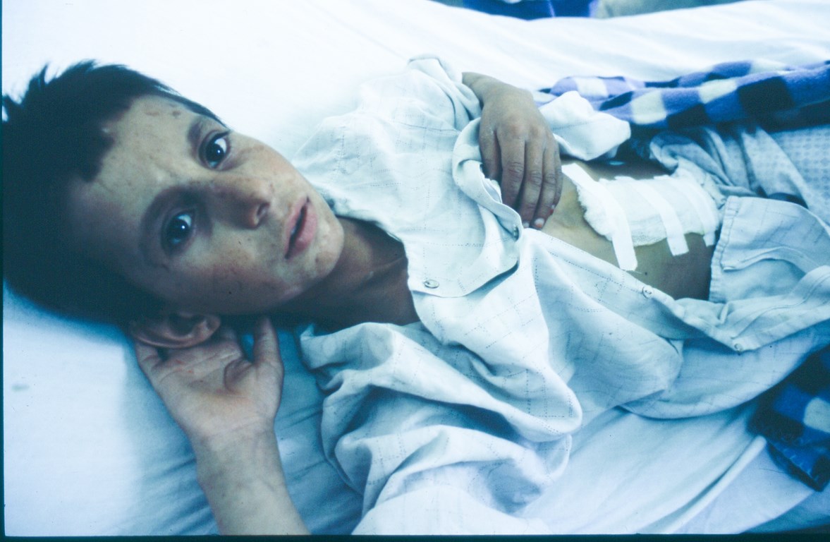 wounded-Afghan-child-2 (Copier)