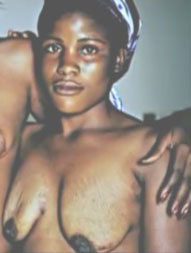 photo-victime-du-repassage-des-seins-CF.CAMEROUNLINK.jpg